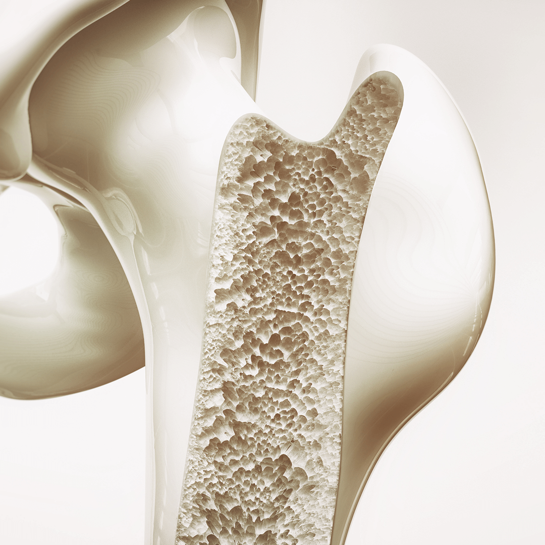 Bone Density Support