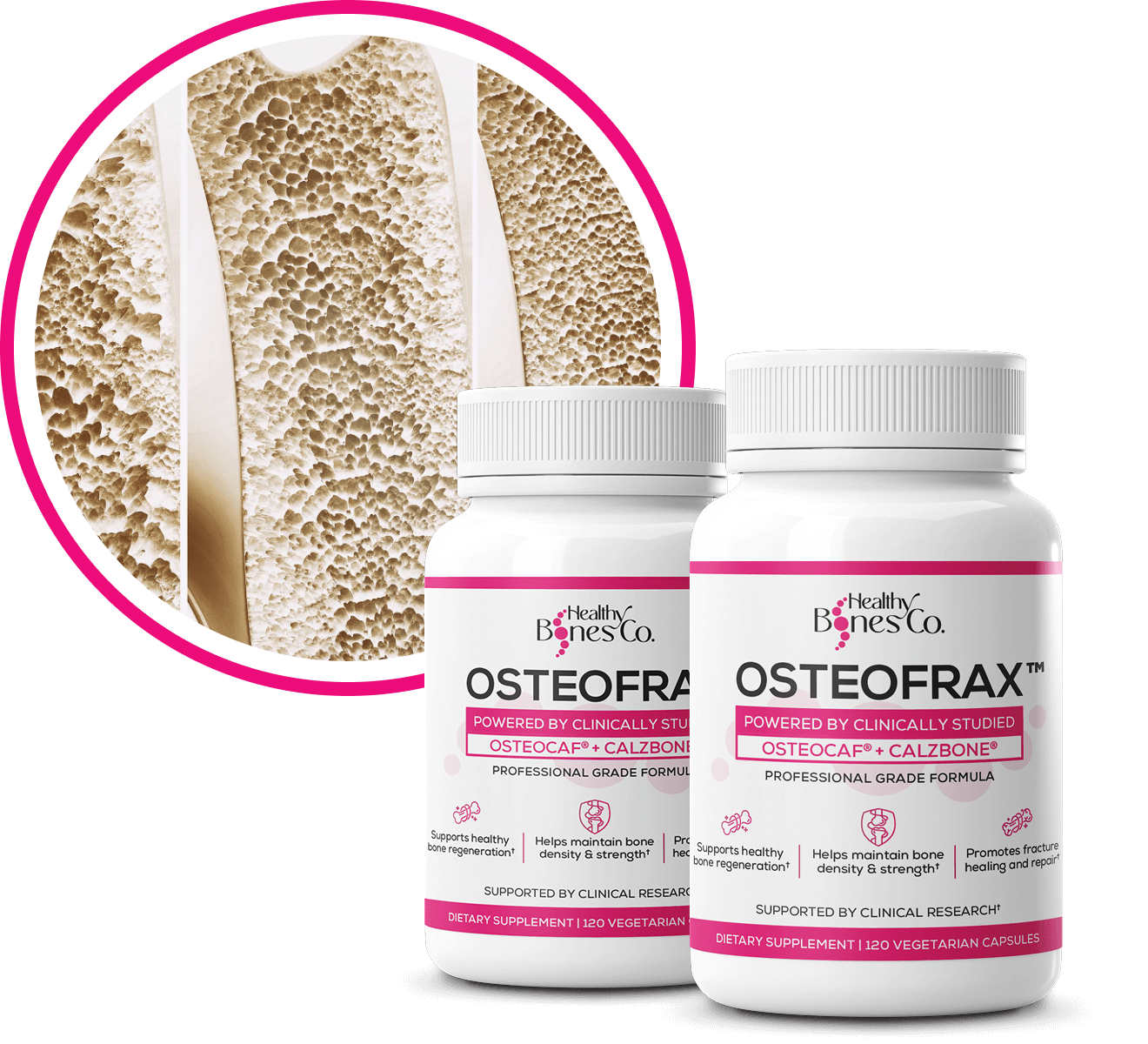 OSTEOFRAX™